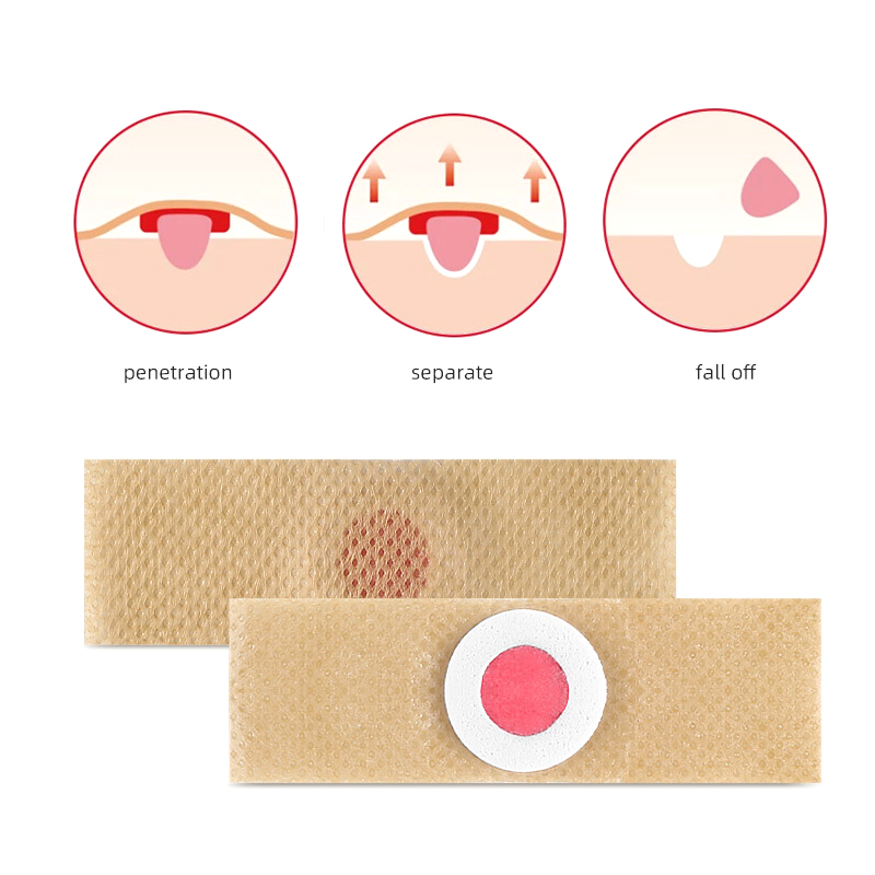 6/48/60/72PCS Voetverzorgingss - Detox Foot Patch recensie en prijs
